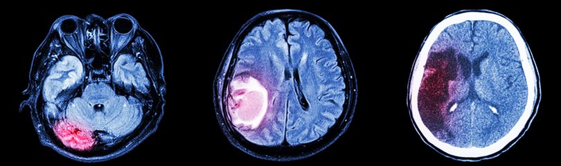 Amazing Brain Facts