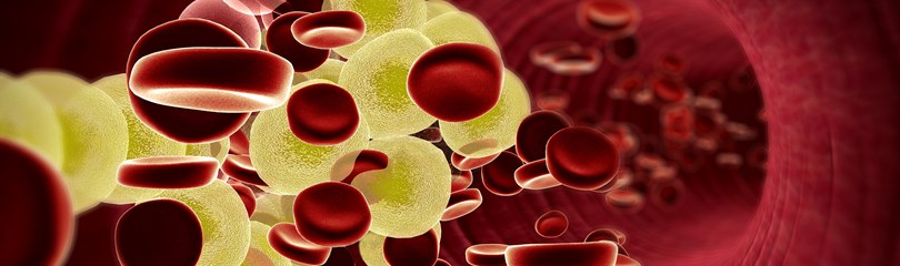 High Cholesterol Facts