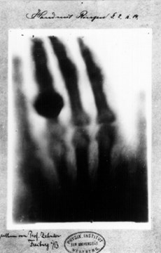 Interesting First  XRay Fact