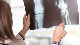 Xray Facts