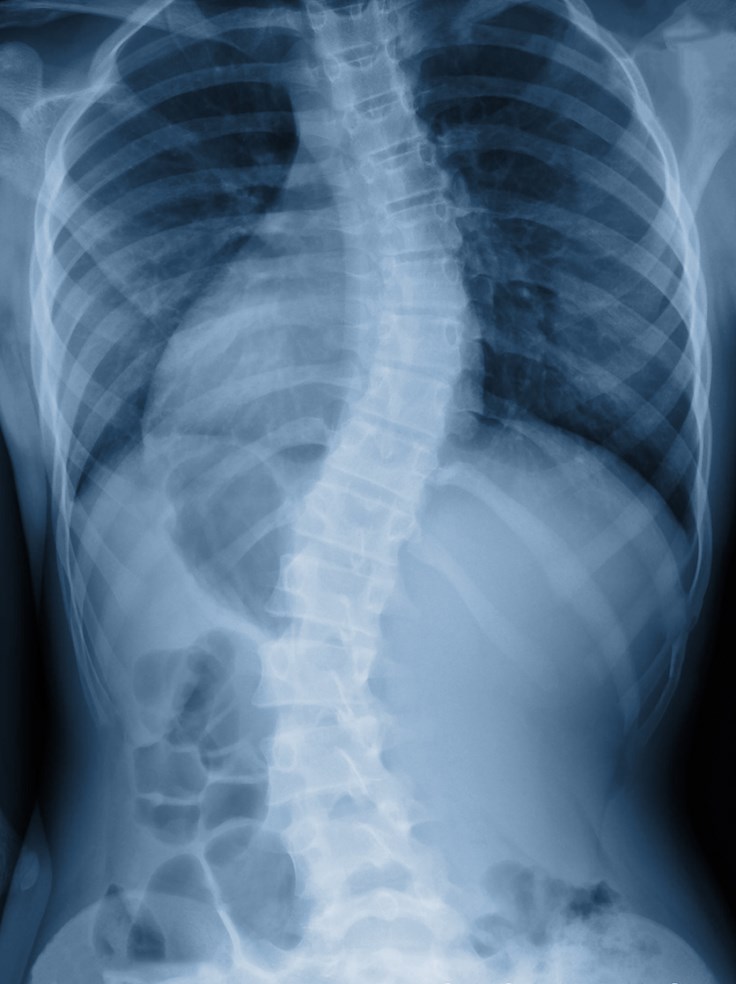 Interesting Facts about Xrays