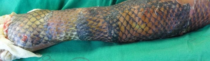 Fish Skin