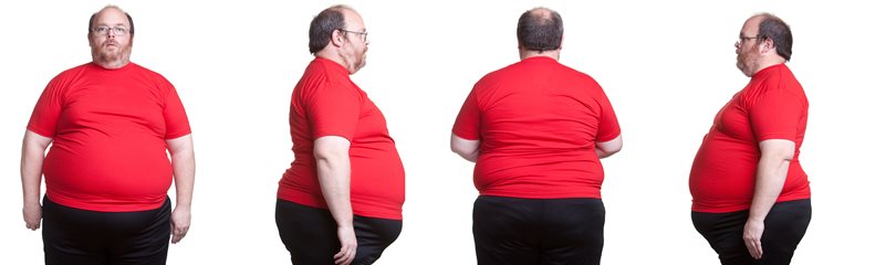Top 10 Obese Countries in the World