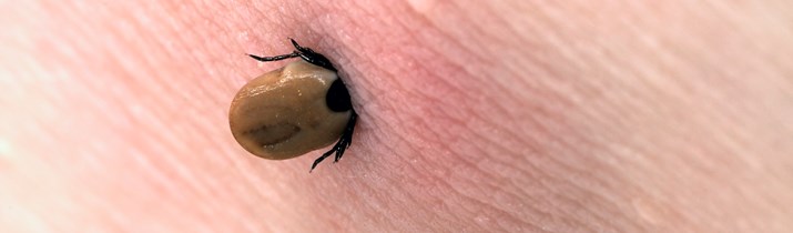 Gross Tick Fact