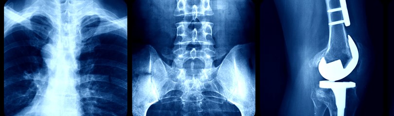 XRay Facts